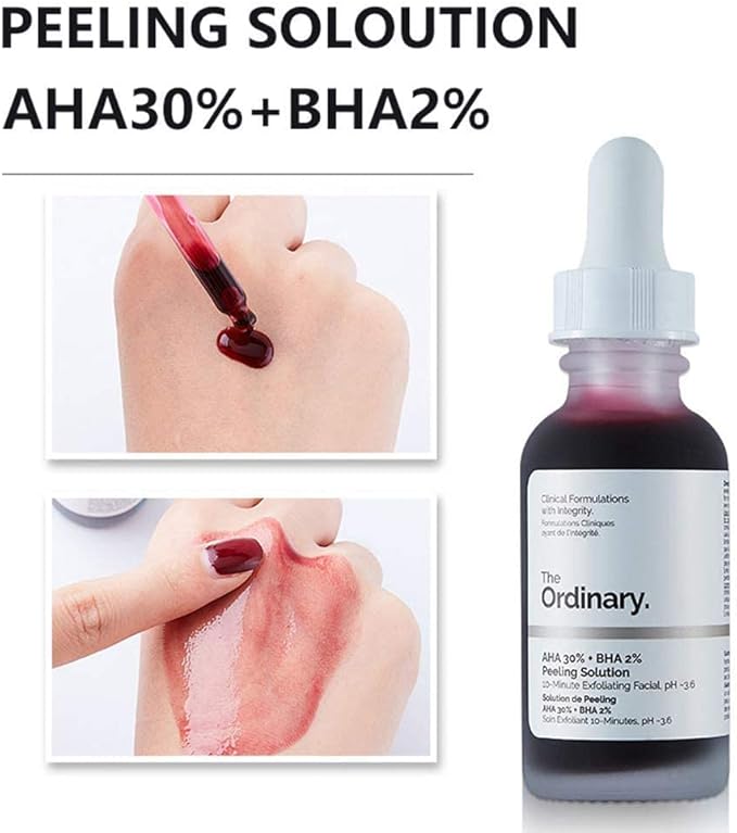 The Ordinary AHA 30% + BHA 2% Peeling Solution, Advanced Exfoliating Peel for Brighter Skin