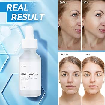 The Ordinary Niacinamide 10% + Zinc 1% 30 ml