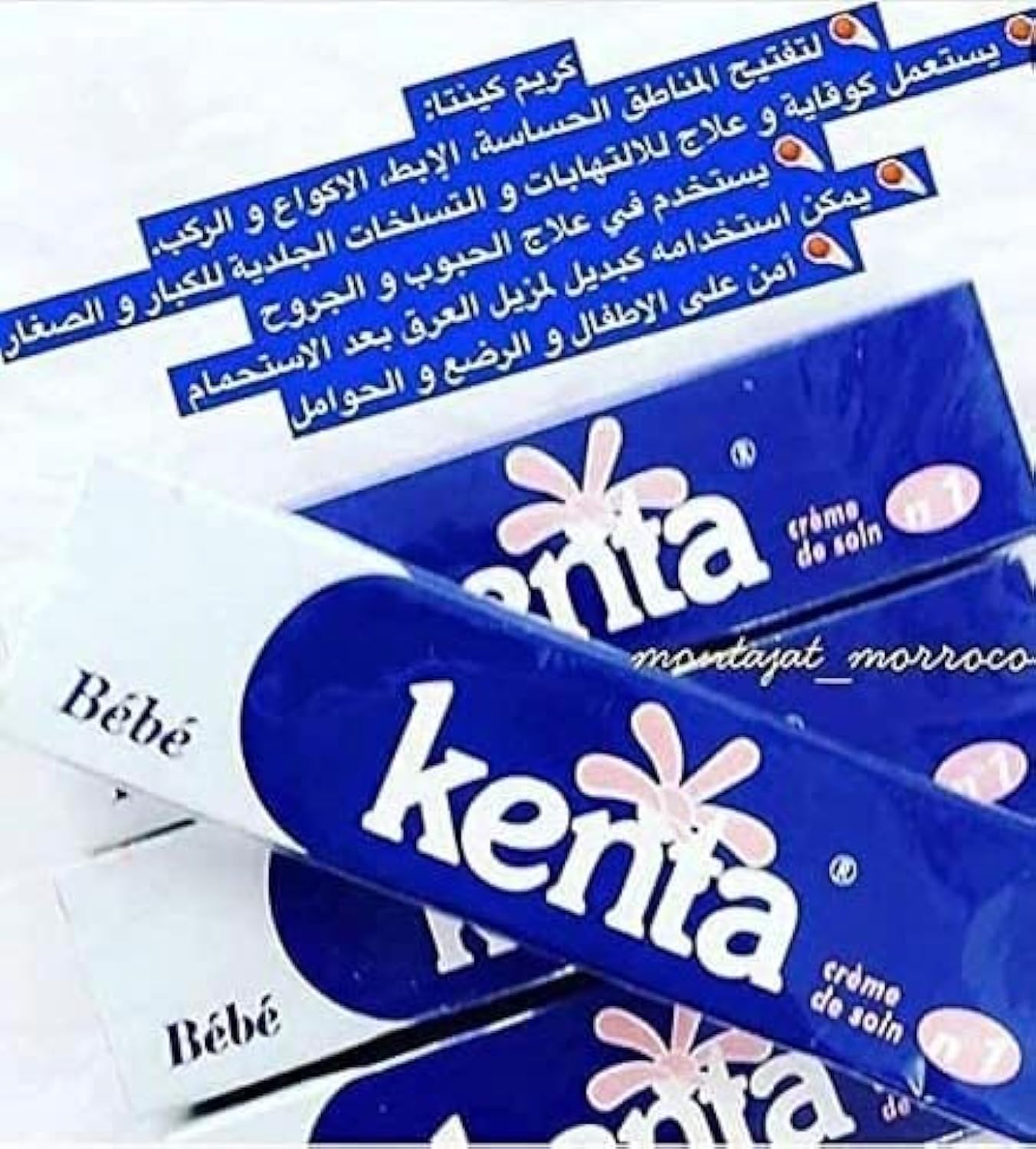 KENTA Baby Cream 30gm - Relieves Skin Irritation