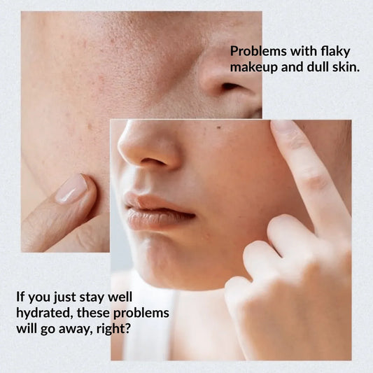 Anua, Birch 70 Moisture, Boosting Serum 70%, 30ml