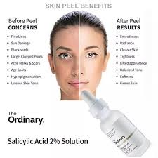 The Ordinary Salicylic Acid 2% Solution 30 ml