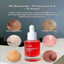 Anua Niacinamide 10%+TXA 4% Dark Spot Correcting Serum 30 ml