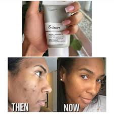 THE ORDINARY Vitamin C Suspension 30% In Silicone Full Size Cream 30ml