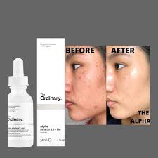 The Ordinary Hyaluronic Acid 2% + B5 30 ml