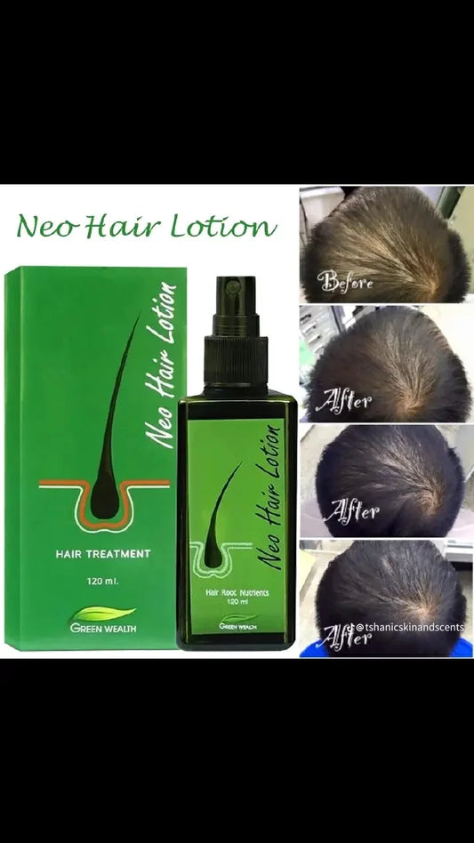 Neo Hair Lotion