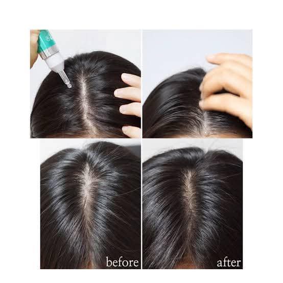 PDRN BOOSTER CARVENCHY HAIR AMPOULE 100dl