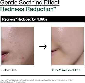 Anua Heartleaf 80% Moisture Soothing Ampoule 30ml