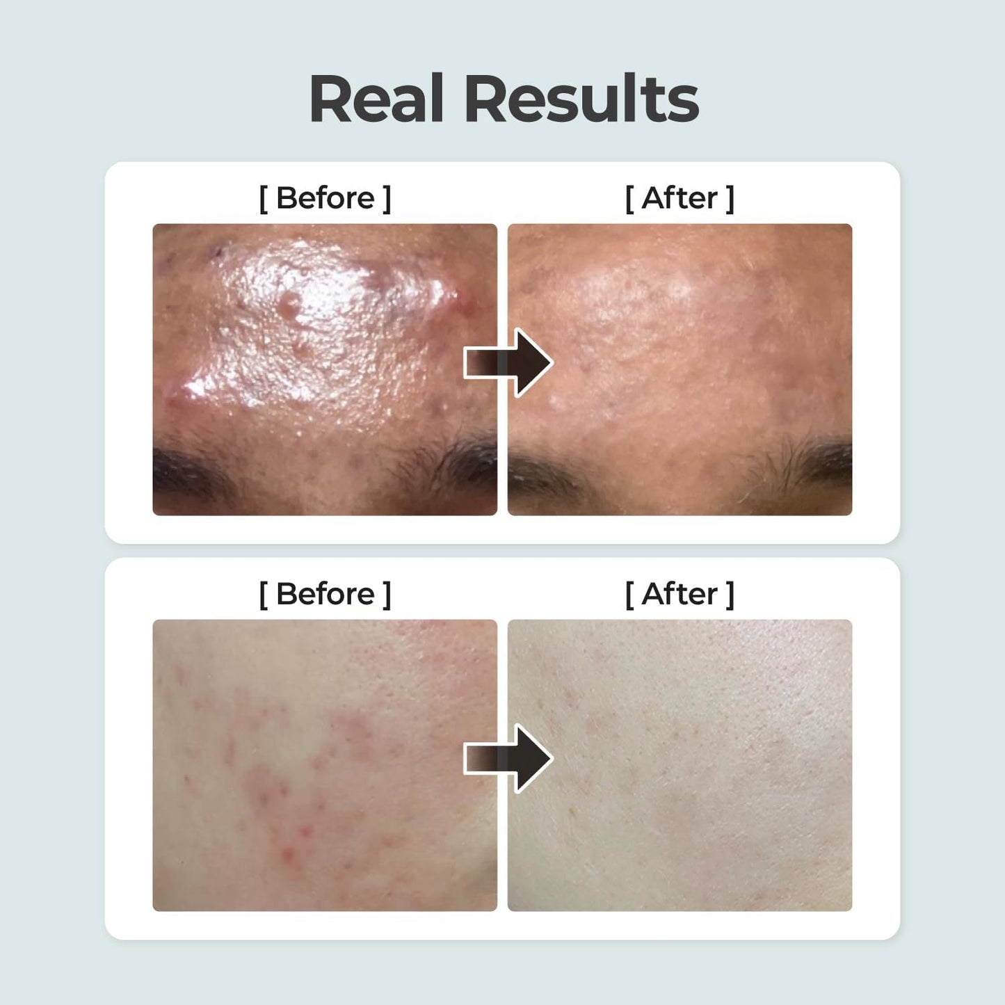 numbuzin No.1 Pure-Full Calming Herb Toner - 300ml