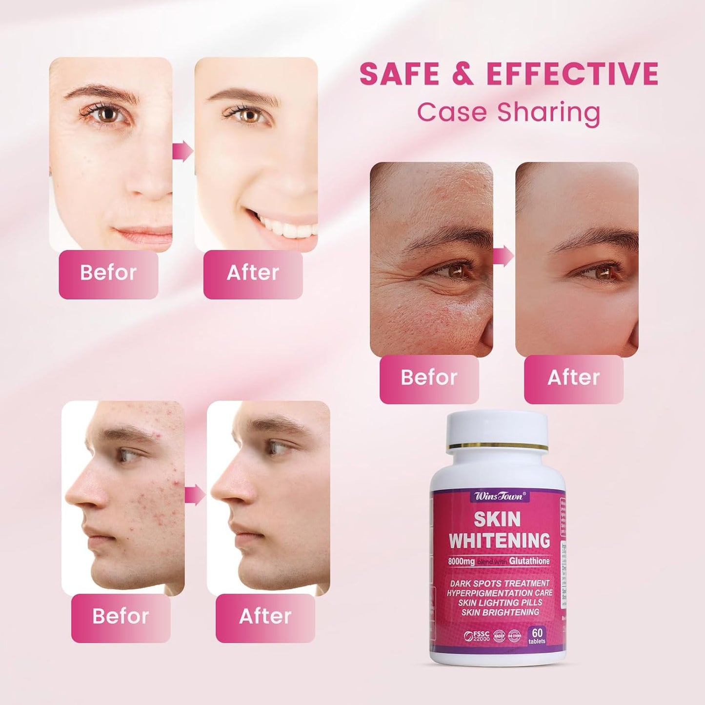 Wins Town Skin Whitening 8000mg blend with Glutathione