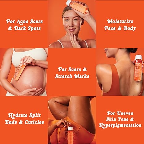 Bio-Oil Skincare Body Oil Serum for Scars and Stretch Marks.  200 ml