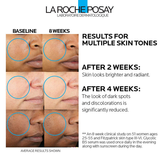LA ROCHE-POSAY Glycolic B5 Serum Dark Spot Corrector Exfoliating Brightening (suitable for Sensitive Skin)