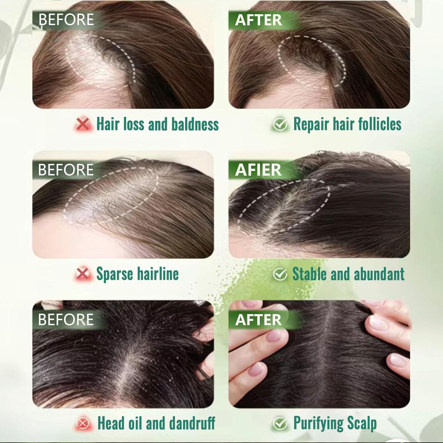 Nature Triangle Shampoo Bar, Nature Seven Green Soap Shampoo, Herbal Hair Care, Gentle Cleansing, Strengthens Hair for Women and Mens With a Foaming