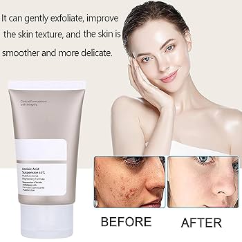 The Ordinary Azelaic Acid Suspension 10%, Formula for Uneven and Blemish-Prone Skin 30ml
