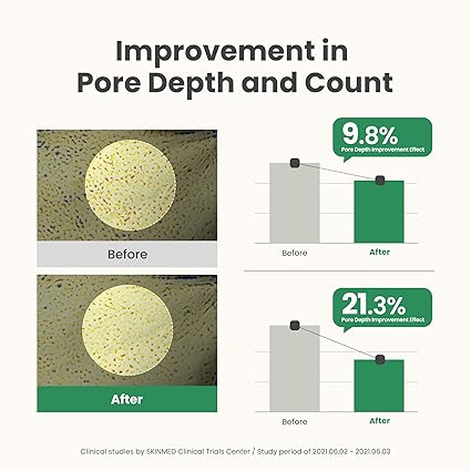 AXIS-Y Mugwort Pore Clarifying Wash Off Pack - Face Exfoliator Targets Clogged Pores, Whitehead & Blackhead Remover - Vegan Korean Skin Care Glass Skin Clay Mask - 3.38 fl. oz.