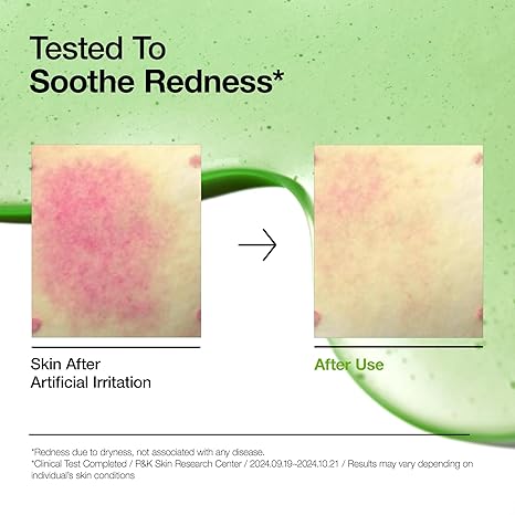 Anua Azelaic Acid 10 Hyaluron Redness Soothing ,