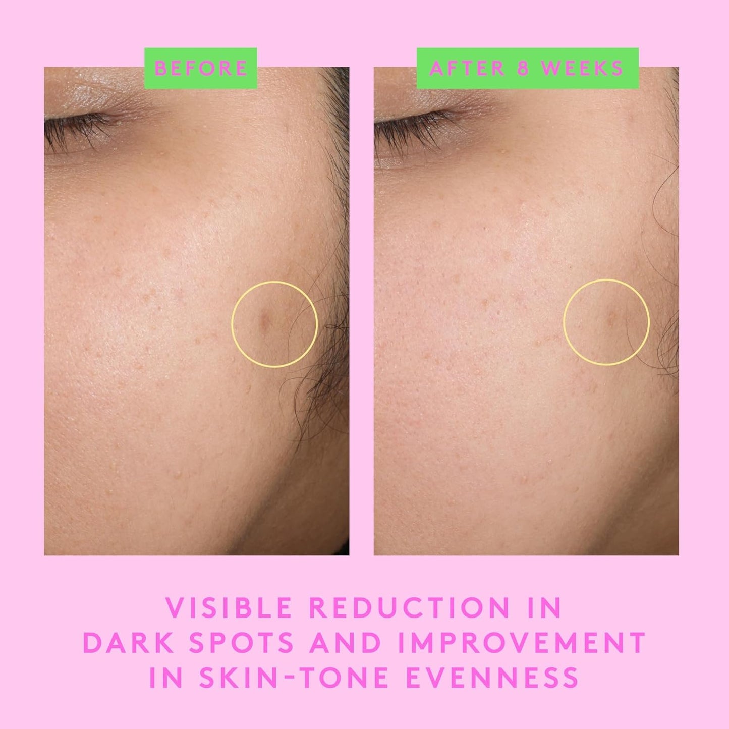Drunk Elephant B-Goldi Bright Drops - 30 ml/1 fl oz - Illuminating Color Serum Drops - Clean Clinical Skincare - Cruelty-Free - Dermatologist-Tested - Free of Essential Oils, Silicones, and Fragrance