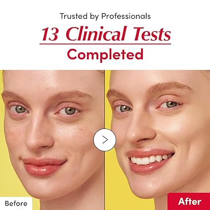 EQQALBERRY Vitamin Illuminating Serum – 40% Acerola, Niacinamide, Arbutin & Ceramide – Brightening & Hydrating Serum for Even Skin Tone