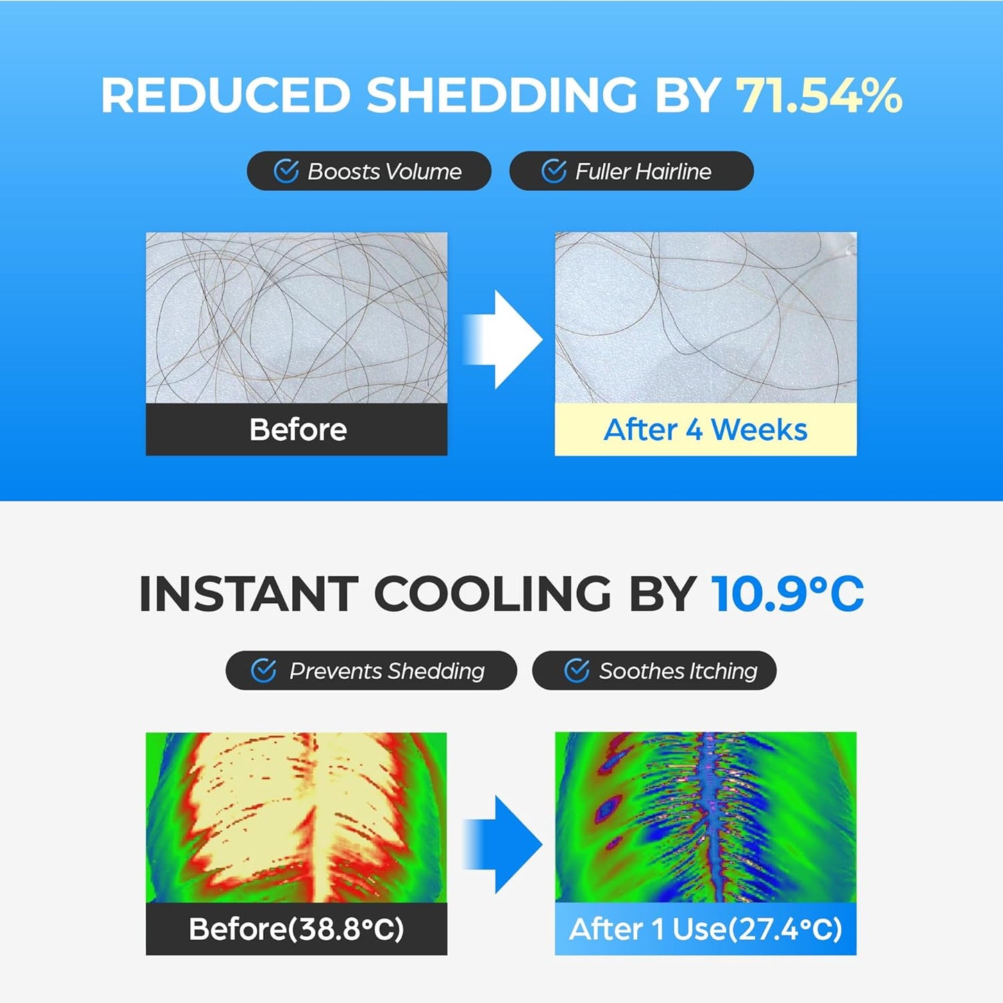 Scalpy Hair Growth Serum for Men & Women for Hair Loss & Thinning