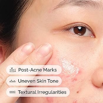 The Ordinary  Aloe 2% + NAG 2% Solution 30ml