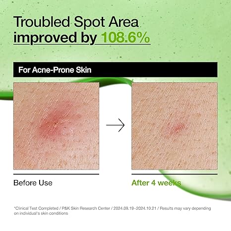 Anua Azelaic Acid 10 Hyaluron Redness Soothing ,
