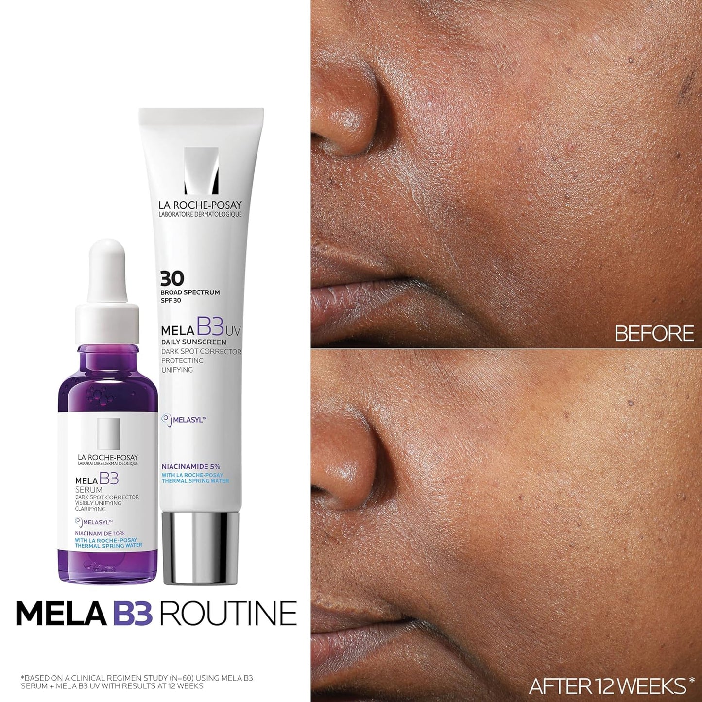La Roche-Posay Mela B3 Serum 30ml – Anti-Dark Spot Serum with Melasyl™ & Niacinamide