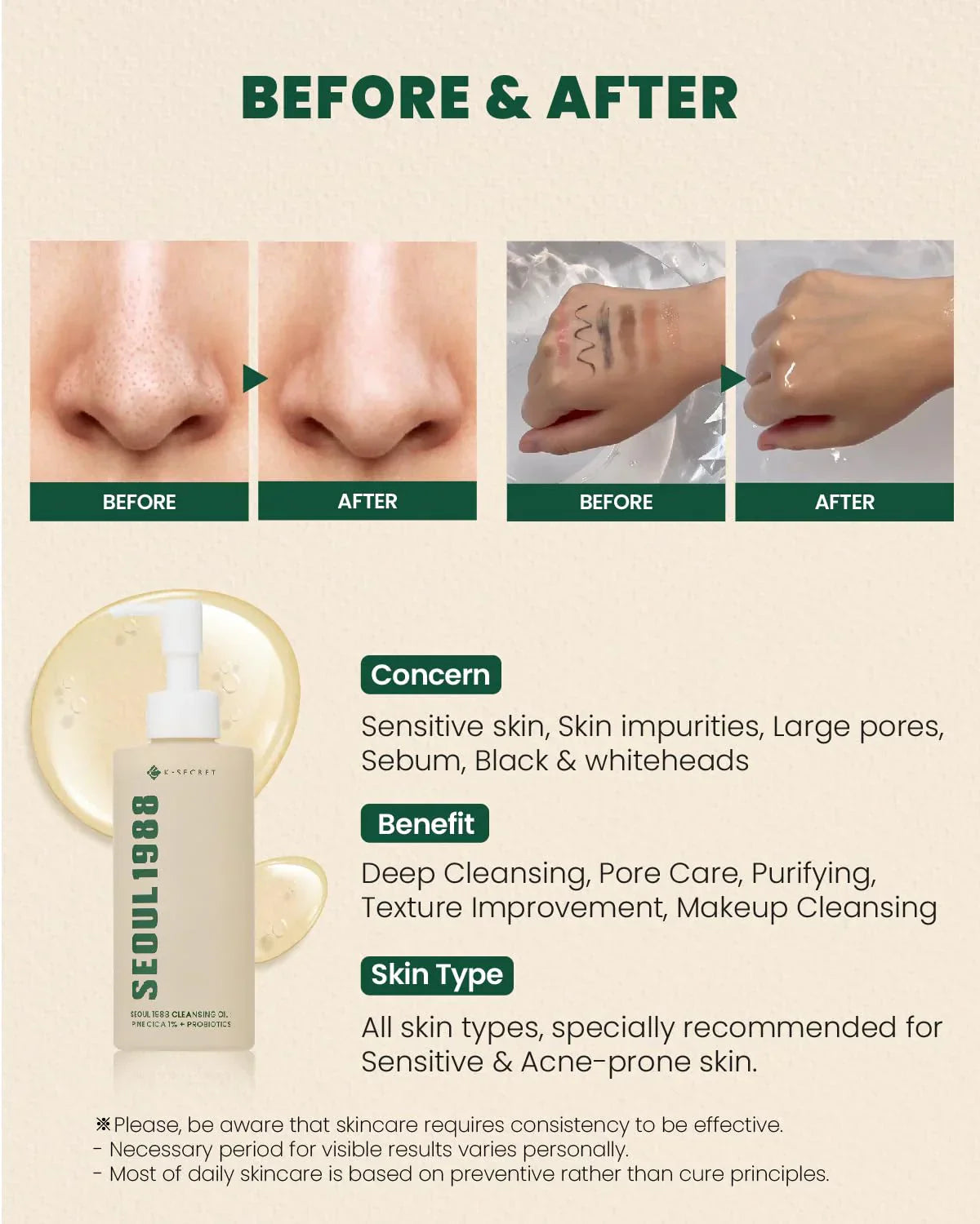 KSECRET SEOUL 1988 Cleansing Oil : Pine Cica 1% + Probiotics, 200ml