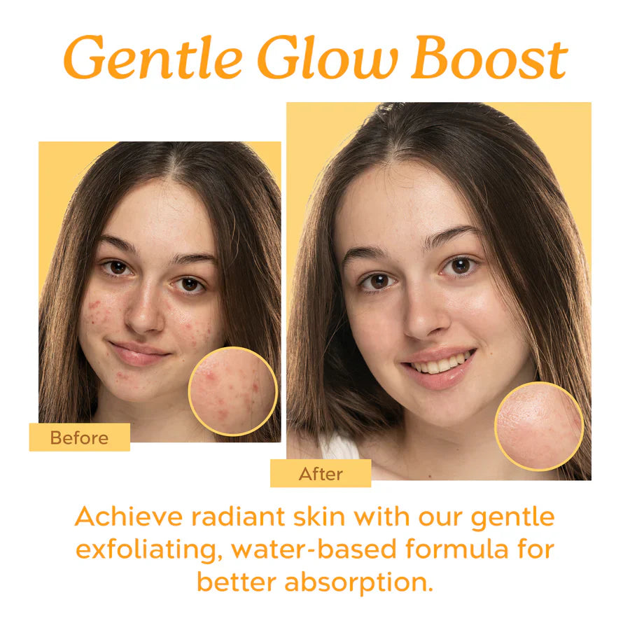 The Ordinary Mandelic Acid 10% + Hyaluronic Acid, Gentle Exfoliating Serum for Clarity and Hydration, 1 Fl Oz