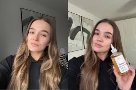 The Ordinary Glycolic Acid 7% Exfoliating Toner, Brightening and Smoothing Daily Toner for More Even-Looking Skin Tone, 8.1 Fl Oz