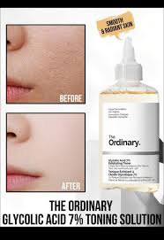 The Ordinary glycolic acid 7% Exfoliating Toning Solution