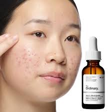 The Ordinary  Aloe 2% + NAG 2% Solution 30ml