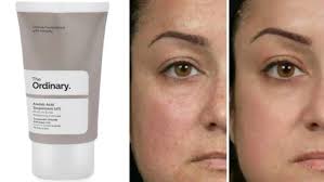 The Ordinary Azelaic Acid Suspension 10%, Formula for Uneven and Blemish-Prone Skin 30ml