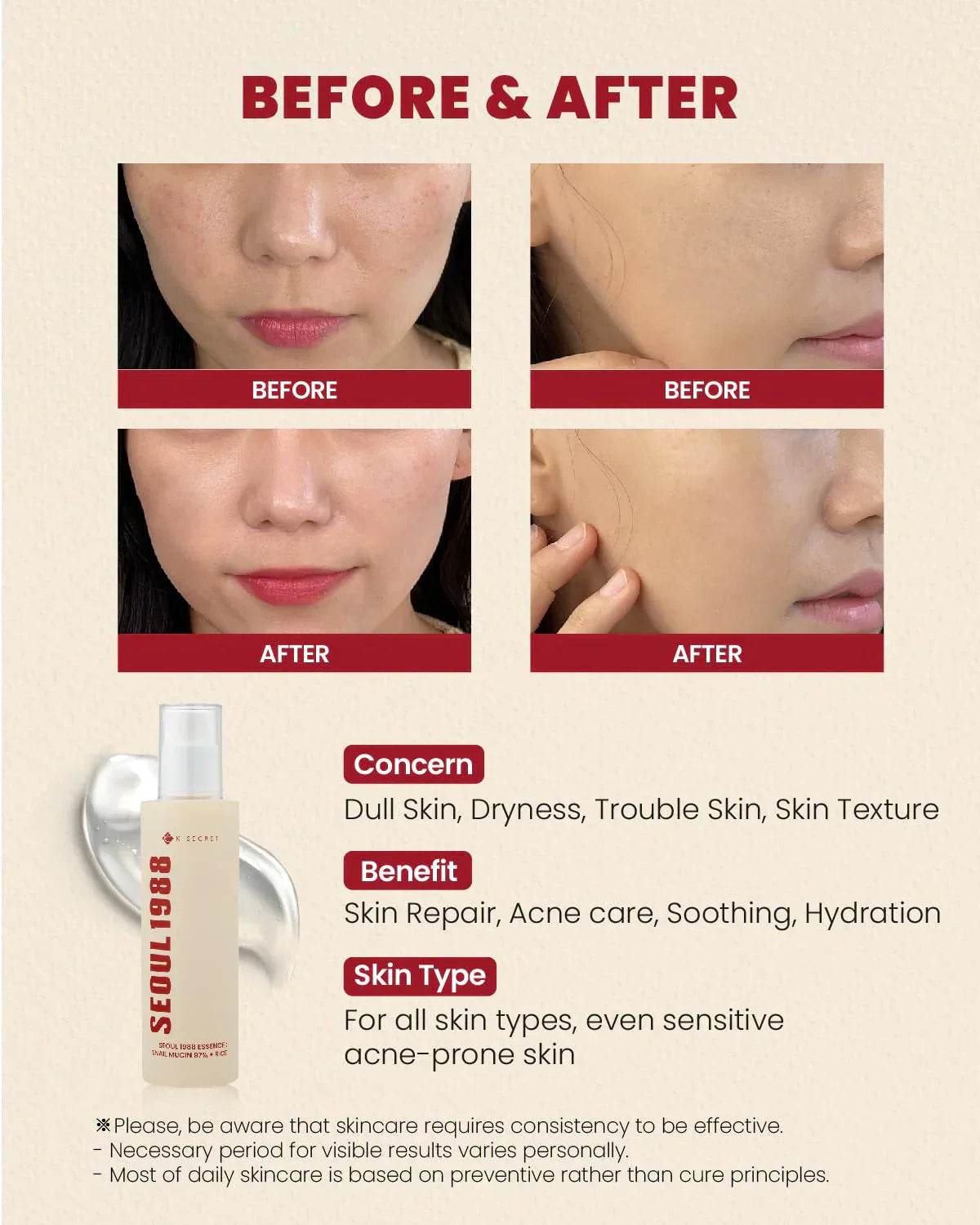 K-SECRET SEOUL 1988 Cream : Snail Mucin 93% + Rice