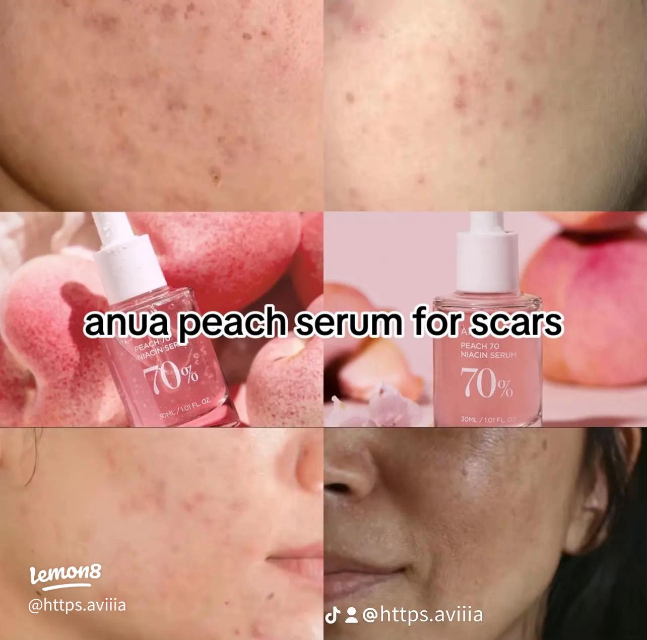 Anua, Peach 70 Niacin Serum 70%, 30ml