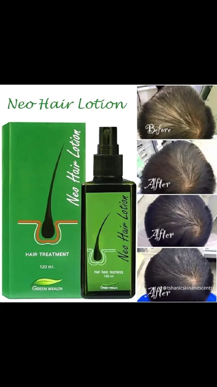 Neo Hair Lotion
