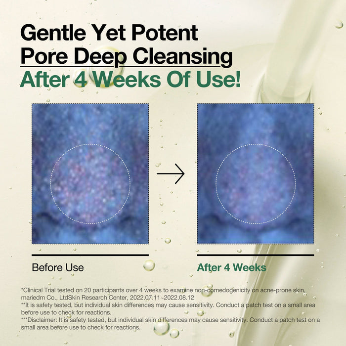 Anua Double Cleansing Duo – Blackhead & Pore Control Set