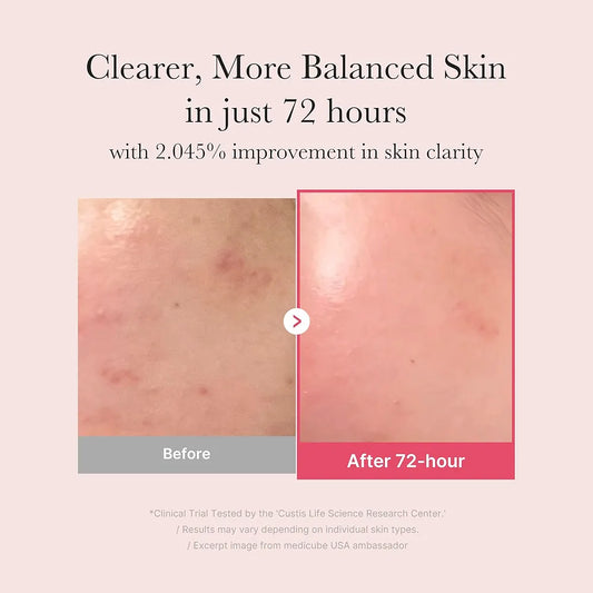 Medicube TXA + Niacinamide 15% Glow Serum — Brightening, Hydration & Spot Care