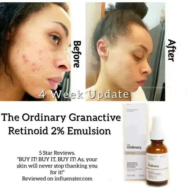 The Ordinary Granactive Retinoid 2% in Squalane 30 ml