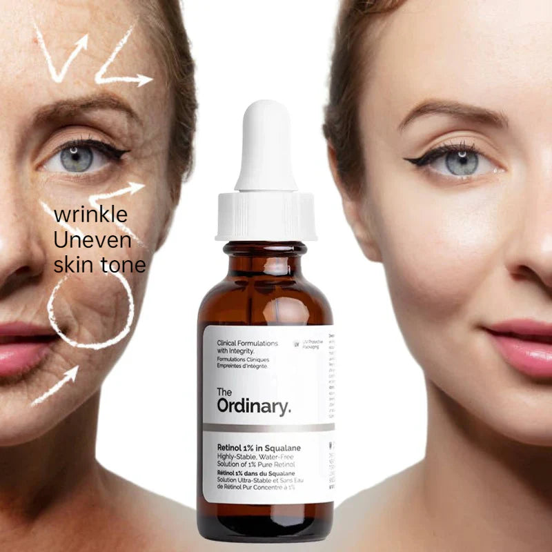 The Ordinary Retinol 1% in Squalane 30 ml