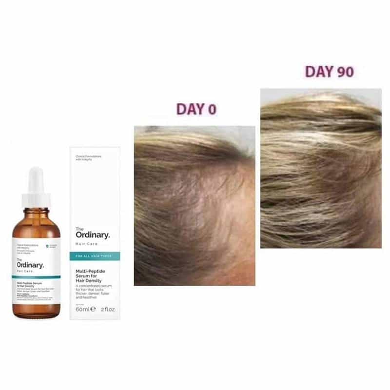 The Ordinary  Multi-Peptide Serum  For Hair Density  60 ml