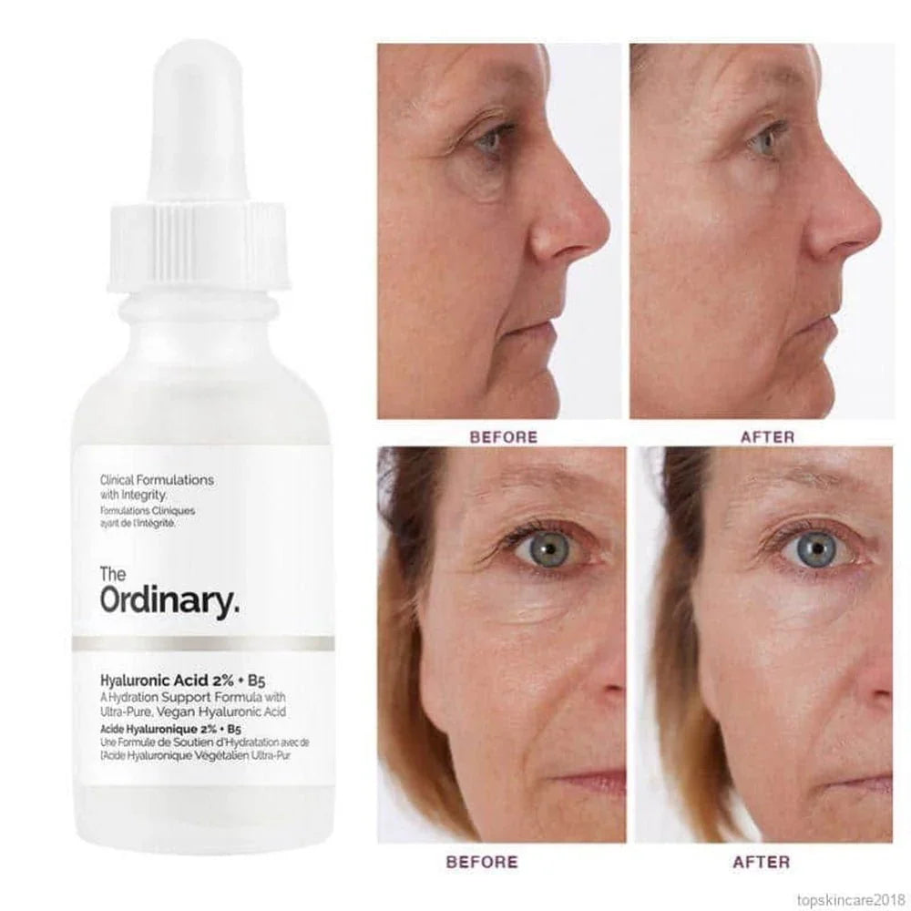The Ordinary  Hyaluronic Acid 2% + B5  30 ml