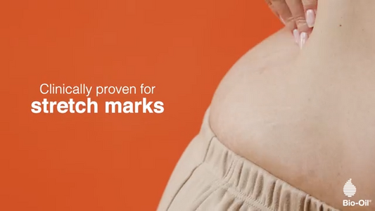 Bio-Oil Skincare Body Oil Serum for Scars and Stretch Marks.  200 ml